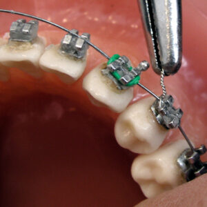 Orthodontics Course