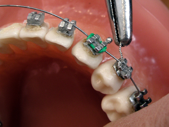 Orthodontics Course